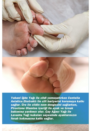 Tto Clinic Ayak Bakım Köpüğü 150 ML