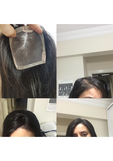 Tığ Işi İnsan Saçı Tepelik.Hilly Lace Front Human Hair