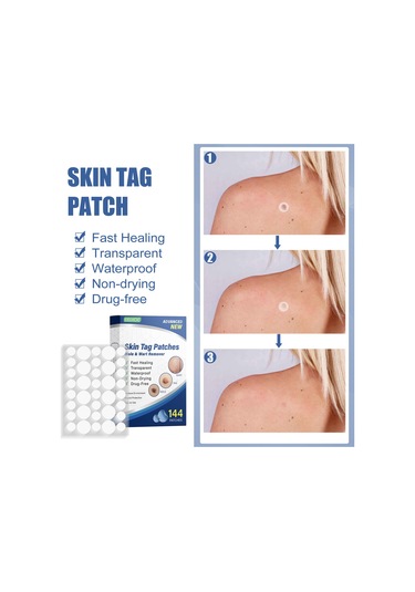 Vkemall Eelhoe Doğal İçerikli Siğil Yapışkanları 144 Adet, Ağrısız Cilt Temizliği, Her Cilt Tipi İçin Uygun, Su Geçirmez Ve Nefes Alabilir.