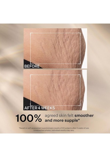 Strivectin Sd Kırışıklık Ve Çatlak Karşıtı Yoğun Nemlendirici Yüz Ve Vücut Kremi 60ml