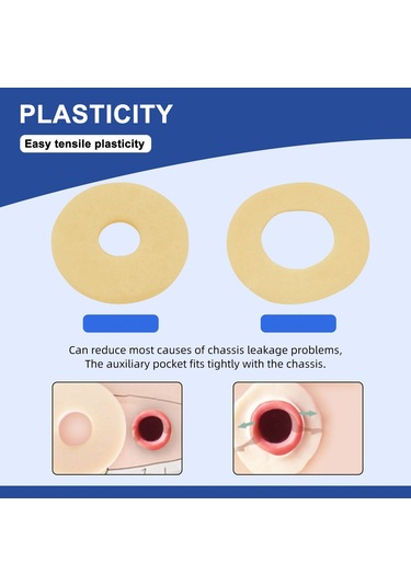 10pcs Ostomi Bariyer Halkaları-dış Çap: 2" 50mm 2mm Kalınlık Tüm Çanta Tipleri Ve Markalarla Uyumlu