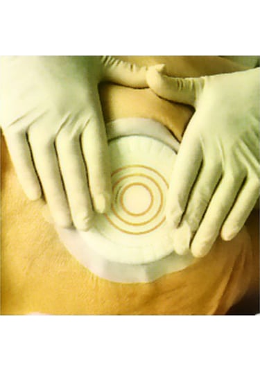 Coloplast 33353 Comfeel Plus Basınç Azaltıcı Yara Örtüsü 10 Adet