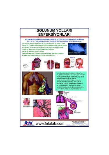 Solunum Yolları Enfeksiyonları Eğitim Plakası