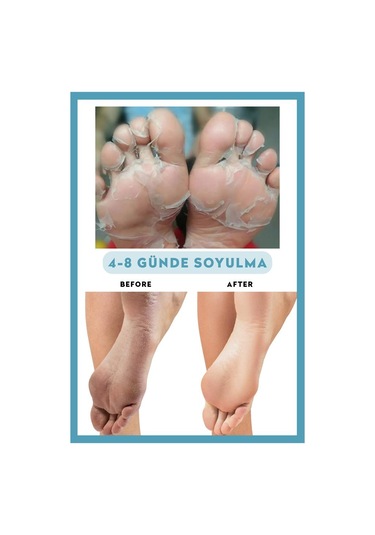 Dermokil Peeling Etkili Soyulabilir Ayak Maskesi 30 ML