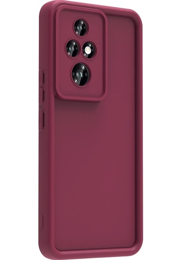 Honor 200 Pro Kılıf Kamera Korumalı Zore Ananas Kapak
