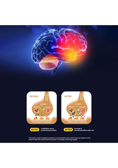 He-m004 Mikro Akımlı Uyku Yardım Cihazı Elde Taşınabilir Anksiyete Giderici Öğeler Akıllı Hipnoz Aracı Masajı Yetişkinler İçin Usb Şarj Edilebilir Rahatlatıcı Altın - Pembe