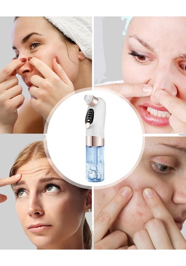 Çok Fonksiyonlu Cilt Bakım Cihazı Siyah Nokta, Gözenek Ve Akne Temizleyici