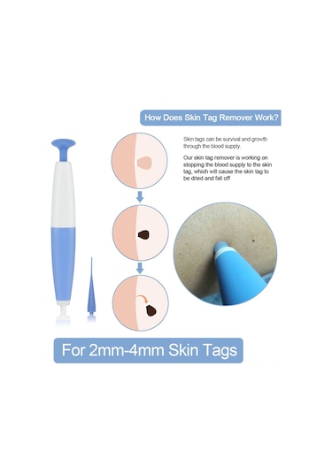 Teltree Cilt Et Beni Çıkarma Kalemi - 4-6mm Et Beni, Siğil Ve Nasır Temizleme Aleti Çok Renkli