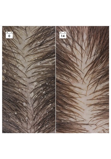 Sephora Collectıon Kepek Karşıtı Nüks Önleyici Serum - Saç Serumu