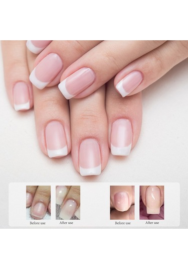 Reedark Profesyonel Fiberglas Tırnak Uzatma Seti - 100/150/200cm Dayanıklı Ve Parlak