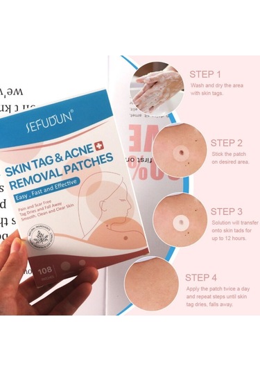 108 Adet Cilt Etiketi Akne Kaldırma Yamalar Ağrısız Pürüzsüz Temiz Temizle Cilt Hızlı Sökücü Sivilce Siğil Ana Yama Tedavisi Korur