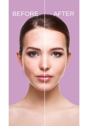 Cremika Ölmez Çiçek Özlü Jel Yüz Maskesi 250 ML