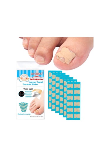 Suntek 1 Set Batık Ayak Tırnağı Düzeltici 72-yaprak