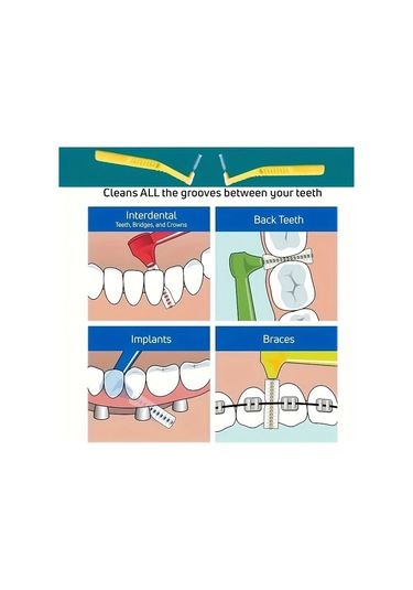 Willowhaven 10 Adet L Şekilli Diş Arası Fırçası - Sarı Paket Oral Temizlik Ve Leke Çıkarıcı