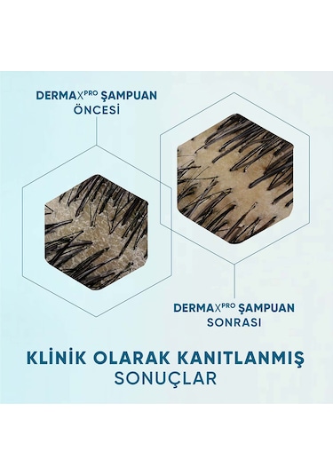 Head & Shoulders Derma X Pro Kafein İle Dökülme Karşıtı Şampuan 300 ML