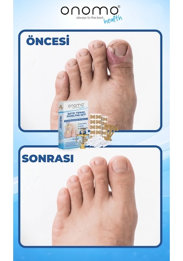 Health Batık Tırnak Düzeltme Seti 61 Adet