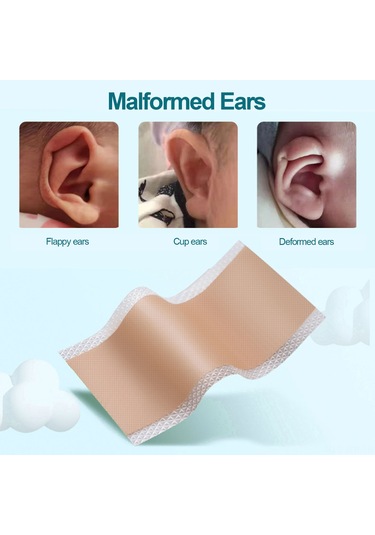 Geeroyoo Yenidoğan Bebekler İçin Su Geçirmez Nefes Alabilir Silikon Kulak Düzeltme Bandı