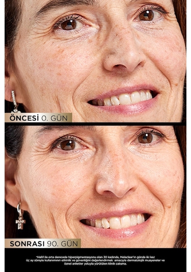 Isdinceutics Melaclear Serum 30 ML