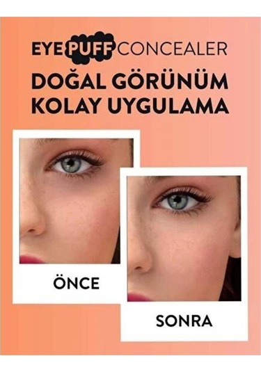Flormar Doğal Bitişli Kremsi Kapatıcı - Eye Puff Concealer - 006 Medium Beige - 8682536021777