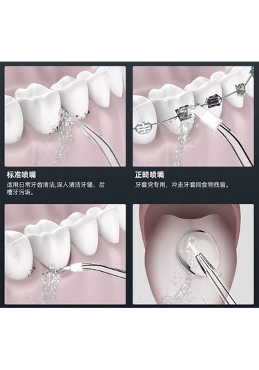 Lichen Elektrikli Su Diş İpi, Elde Taşınabilir Su Diş İpi, Ev