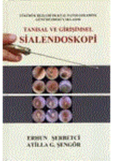 Tanısal Ve Girişimsel Sialendoskopi- Nobel Tıp Kitabevleri