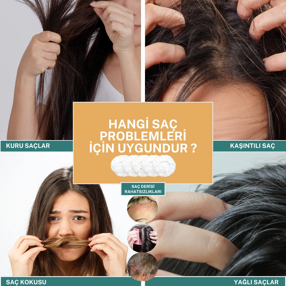 Gümüş Iyon & Biyopolimer Kitin Duruluma Gerektirmeyen Saç Bonesi