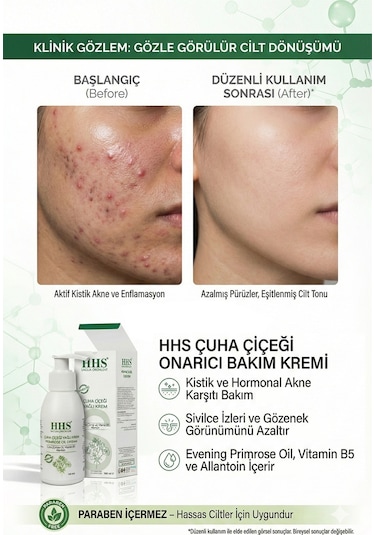 Hhs uha Çiçeği Yağlı Krem Parabensiz 100 ML
