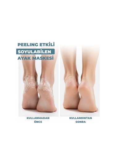 Dermokil Peeling Etkili Çorap Tipi Soyulabilir Ayak Maskesi 30 Ml X 3 Adet