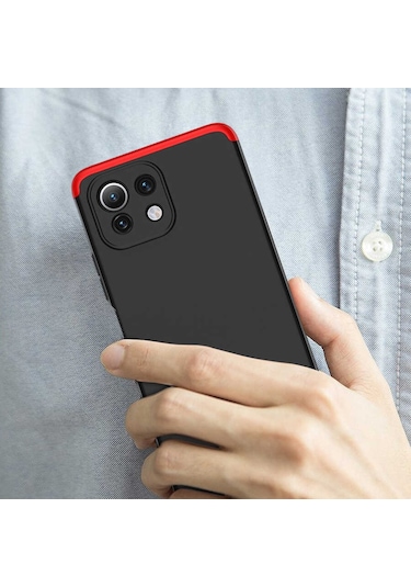 Xiaomi Mi 11 Lite Kılıf Zore Ays Full Koruma Kılıf