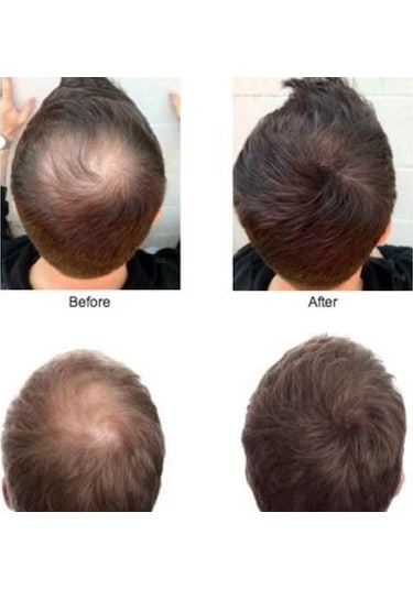 Sevich 100 Gr Siyah Orta Koyu Kahve Saç Fiberi Keratin Saç Tozu