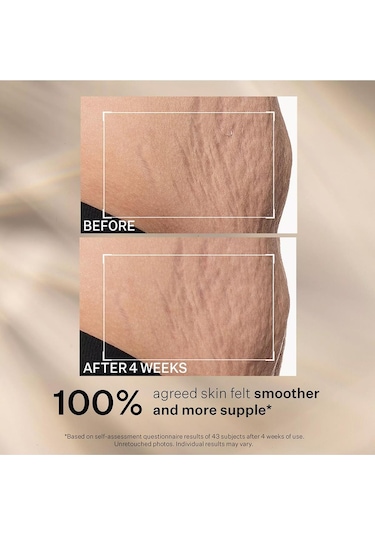 Strivectin Sd Kırışıklık Ve Çatlak Karşıtı Yoğun Nemlendirici Yüz Ve Vücut Kremi 118ml