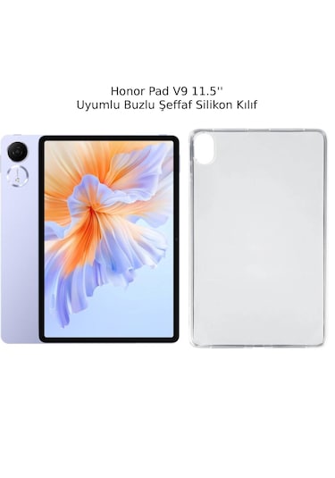 Honor Pad V9 11.5'' Uyumlu Buzlu Şeffaf Silikon Kılıf