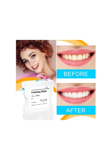 Skycity Dental İki Adet Mavi İnce Zımpara Şeridi - Dişler İçin Parlatma Ve Taşlama