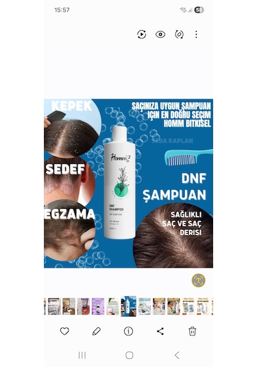Dnf Şampuan 400 Ml Kepekli - Yağlı