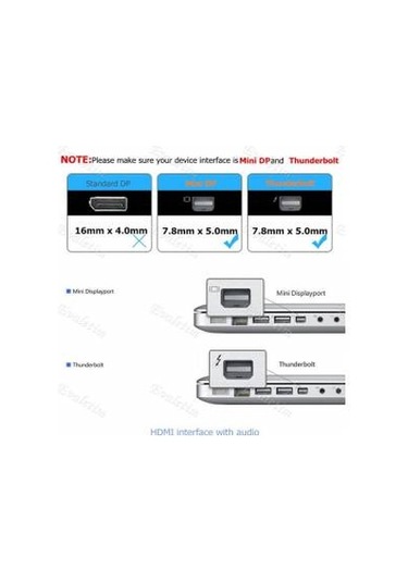 Mini Displayport To Hdmi Dvi Vga 4474P 3.5Mm Kulaklik Çevirici