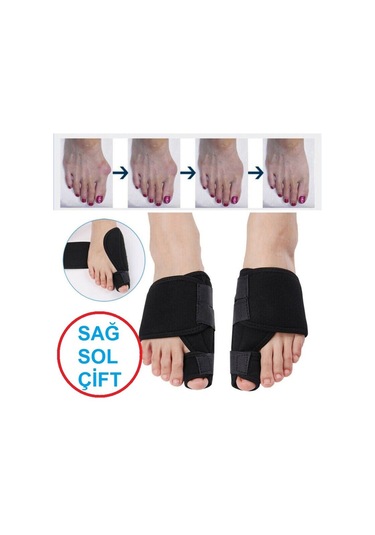 Ankaflex Halluks Valgus Gece Ateli Hallux Başparmak Düzeltici Atel