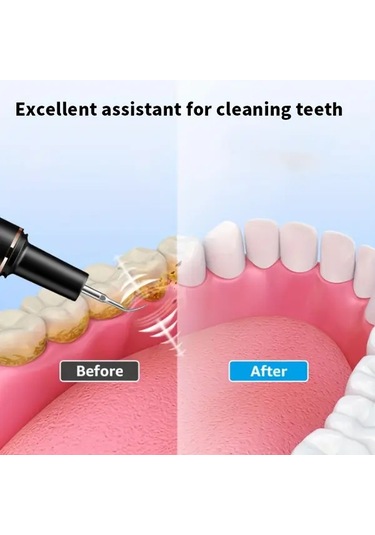 Willowhaven Usb Şarjlı Led Diş Temizleme Seti - 5 Hızlı Beyaz Diş Bakım Aleti Ek Uçlu Seyahat