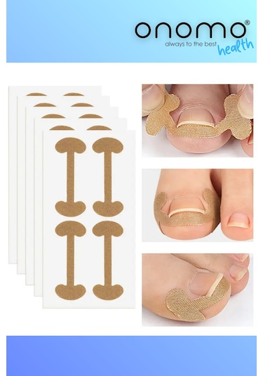 Batık Tırnak Düzeltme Bandı 20 Adet