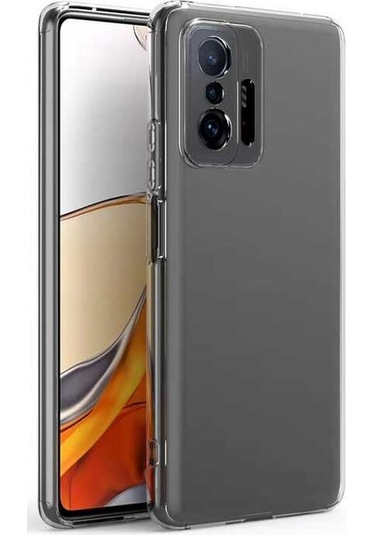 Adige Xiaomi Mi 11t 5g Kılıf Kamera Korumalı Süper Silikon