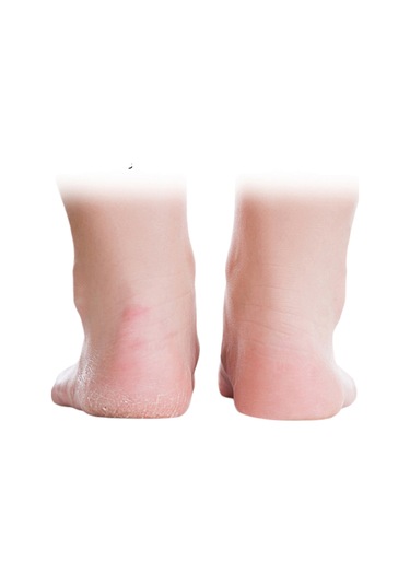 Akestoria Med Ayak Bakım Çorabı Yumuşak Silikon Patik Çorap 2'li Fc-031 M