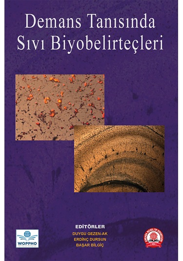 Demans Tanısında Sıvı Biyobelirteçler