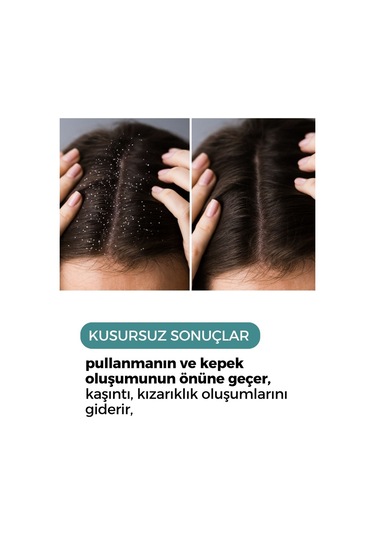 Zento Hair Scalp AntıiDandruff Kepek Şampuanı 250 ML