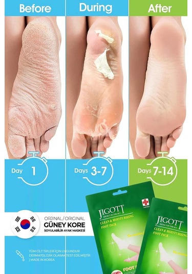 Jigott Çorap Tipi Soyulan Ayak Peeling Maskesi