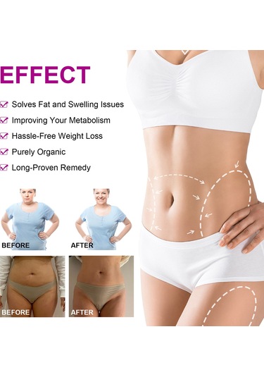 Vkemall Eelhoe Karın Sıkılaştırıcı Yapışkan, Cilt Gerdirme Ve Şekillendirme İçin 5'li Paket