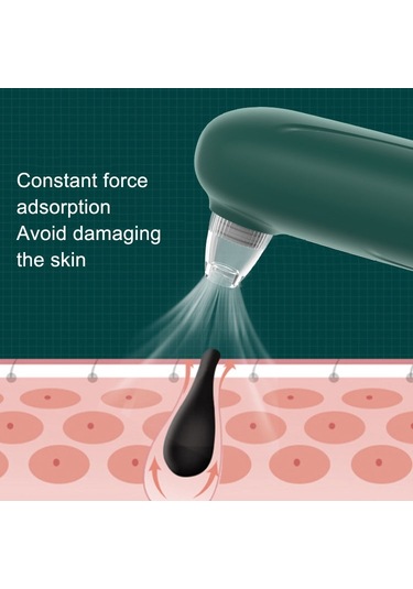 Sones Görsel Siyah Nokta Temizleyici Elektrikli Siyah Nokta Emici Yeşil