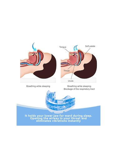 Mufunye Horlamayı Önleyen Ve Diş Gıcırdatmayı Durduran Ergonomik Ağızlık Seti