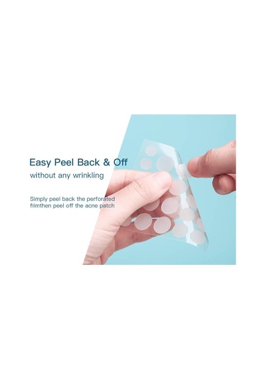 Youtek Sivilce Yama Seti - 144 Adet Hidrokolloid Yama & Çay Ağacı Yağı - Hassas Ciltler İçin Not: 113 Karakter Sınırına Uygun Olarak Optimize Edilmiştir