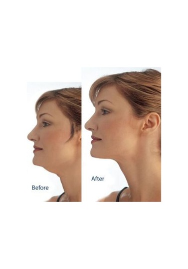 Büro Ev Ofis Personel Bakımı İçin Boyun Gıdı Toparlama Masaj Aleti Gri