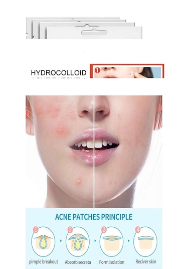 Tbyshop Akne Sivilce Bandı - Acne Patch
