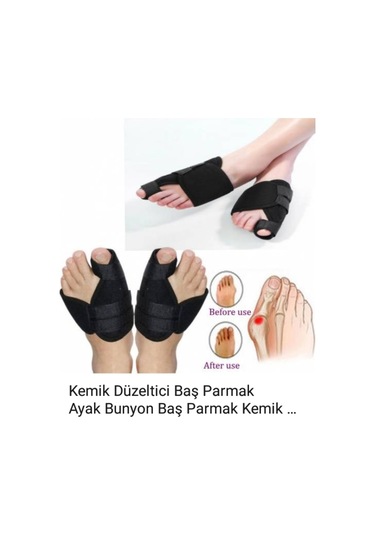 Ayak Kemik Düzeltici Halluks Valgus Gece Ateli